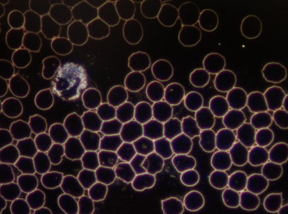 Dunkelfeld Mikroskopie – gesundes Blut